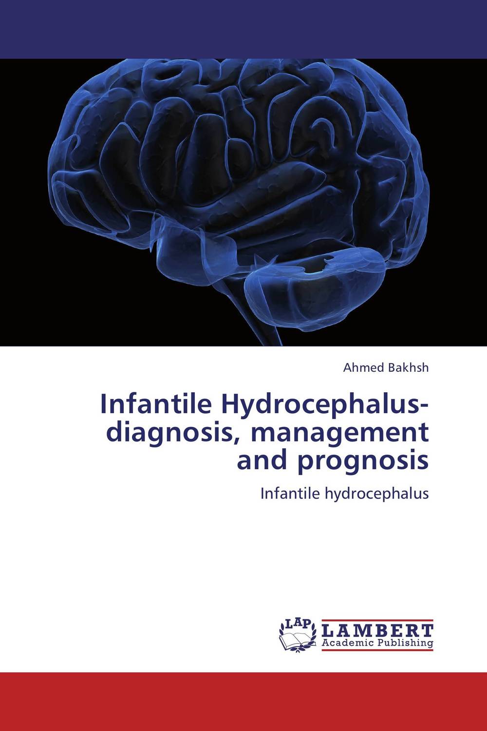 Фото Infantile Hydrocephalus-diagnosis, management and prognosis. Купить  в РФ