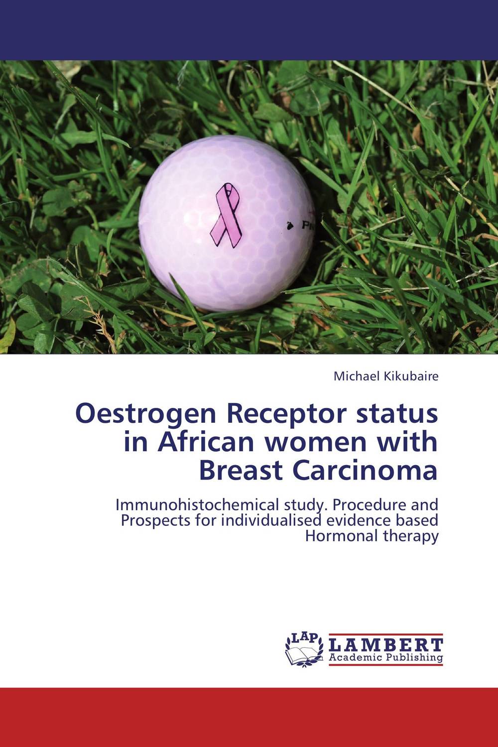 Фото Oestrogen Receptor status in African women with  Breast Carcinoma. Купить  в РФ