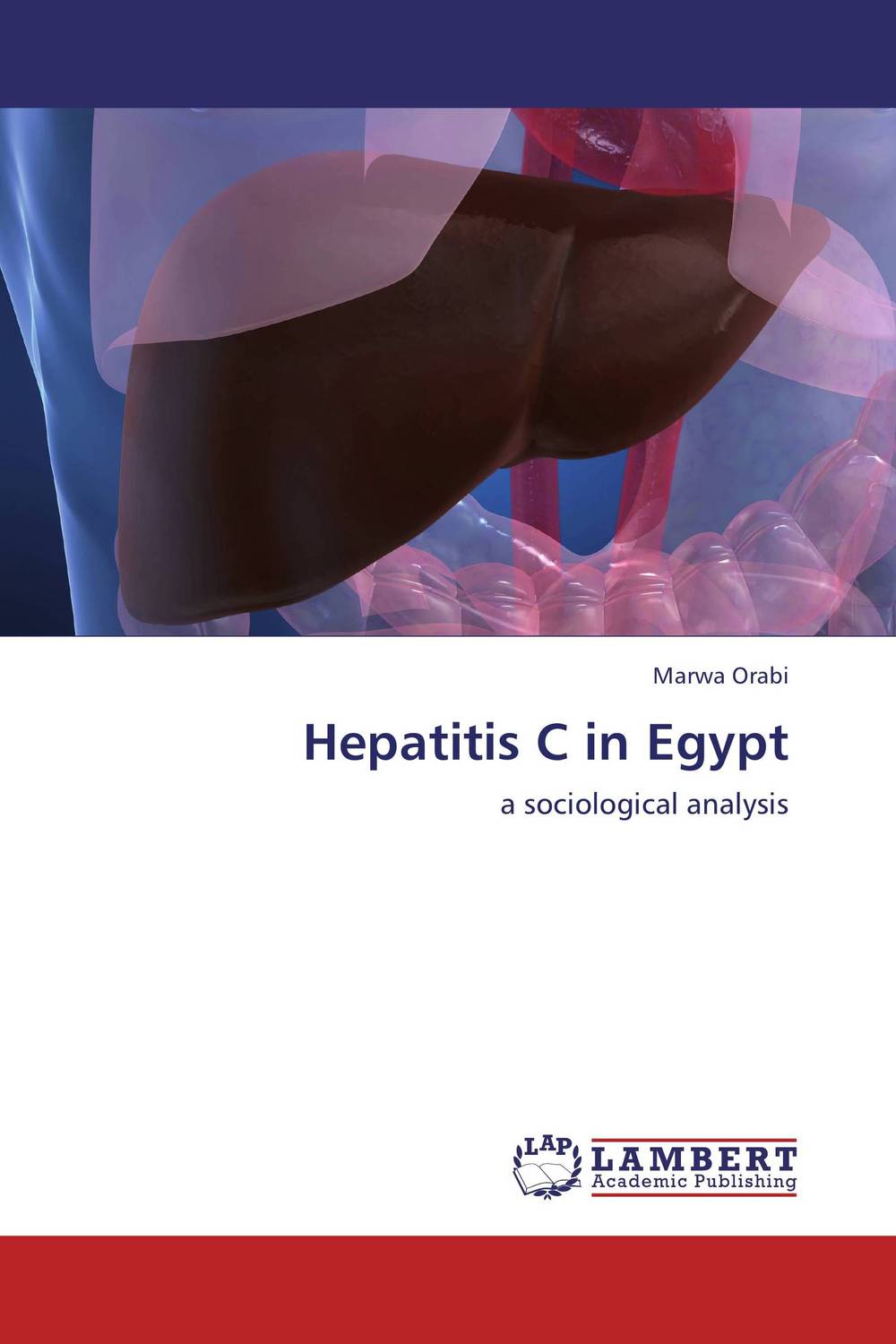 Фото Hepatitis C in Egypt. Купить  в РФ