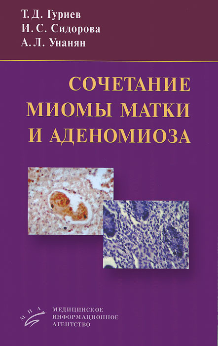 Сочетание миомы матки и аденомиоза. Т. Д. Гуриев, И. С. Сидорова, А. Л. Унанян