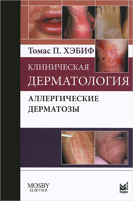 Клиническая дерматология. Аллергические дерматозы. Томас П. Хэбиф