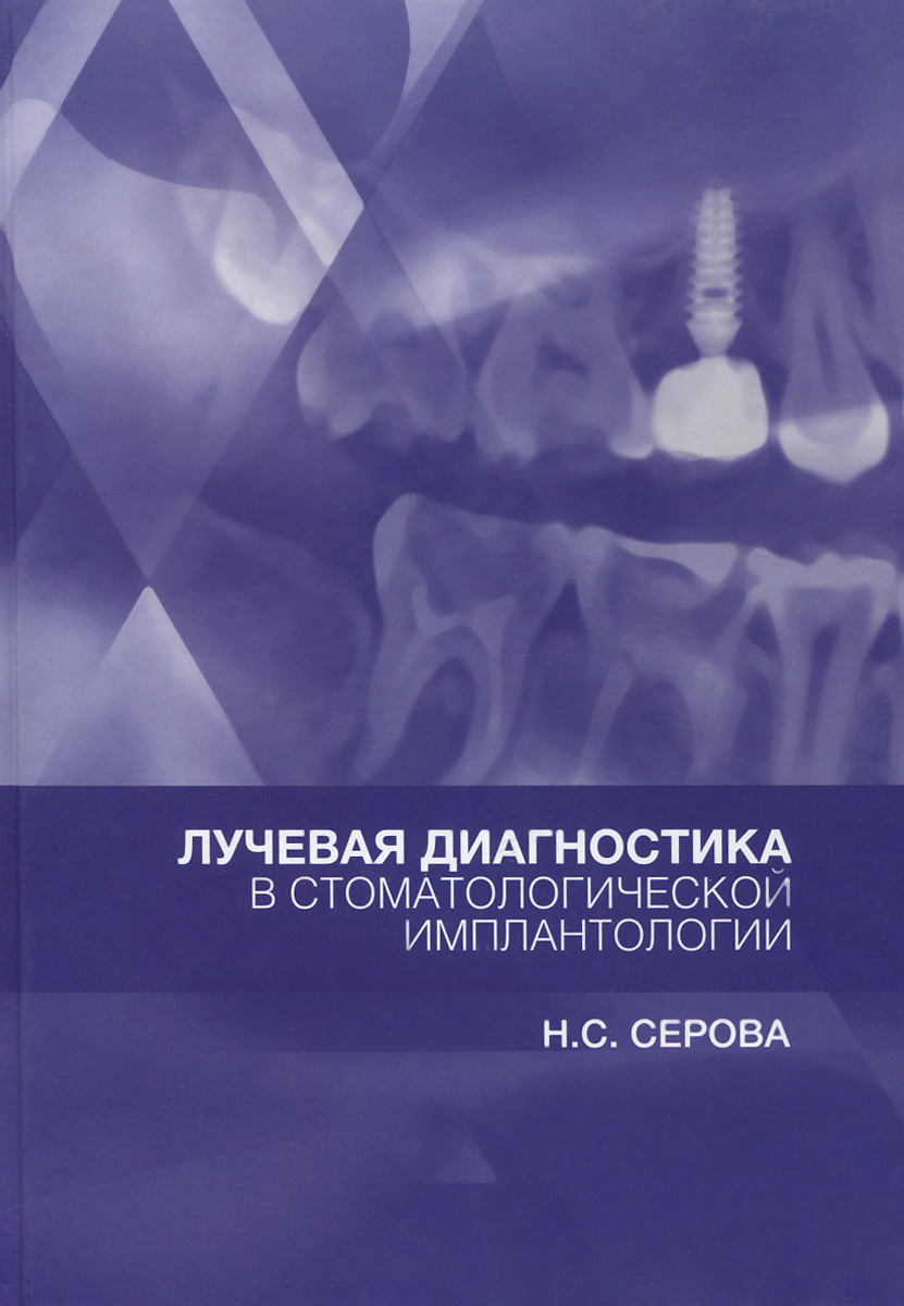 Лучевая диагностика в стоматологической имплантологии. Н. С. Серова
