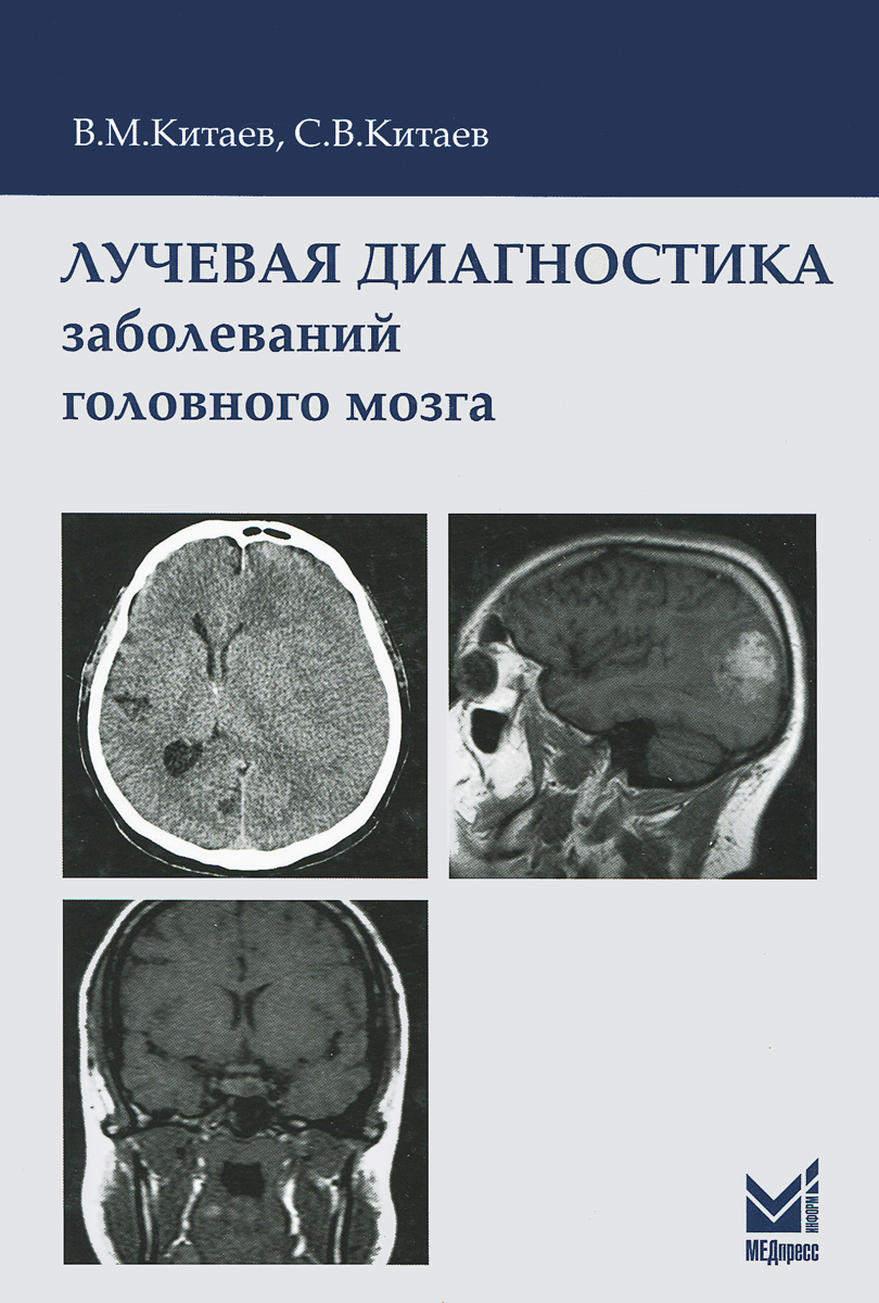 Лучевая диагностика заболеваний головного мозга. В. М. Китаев, С. В. Китаев