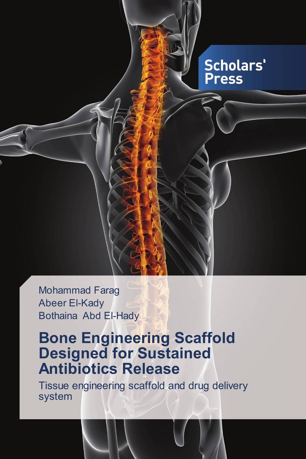 Bone Engineering Scaffold Designed for Sustained Antibiotics Release art of bone