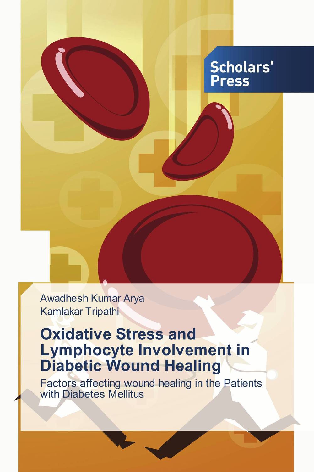 Oxidative Stress and Lymphocyte Involvement in Diabetic Wound Healing tissue adhesive versus standard wound closure technique