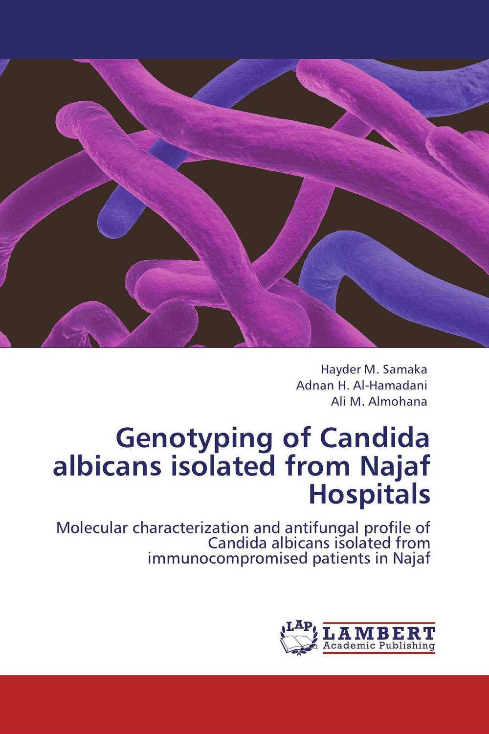 Genotyping of Candida albicans isolated from Najaf Hospitals murine immune responses to strains of candida albicans