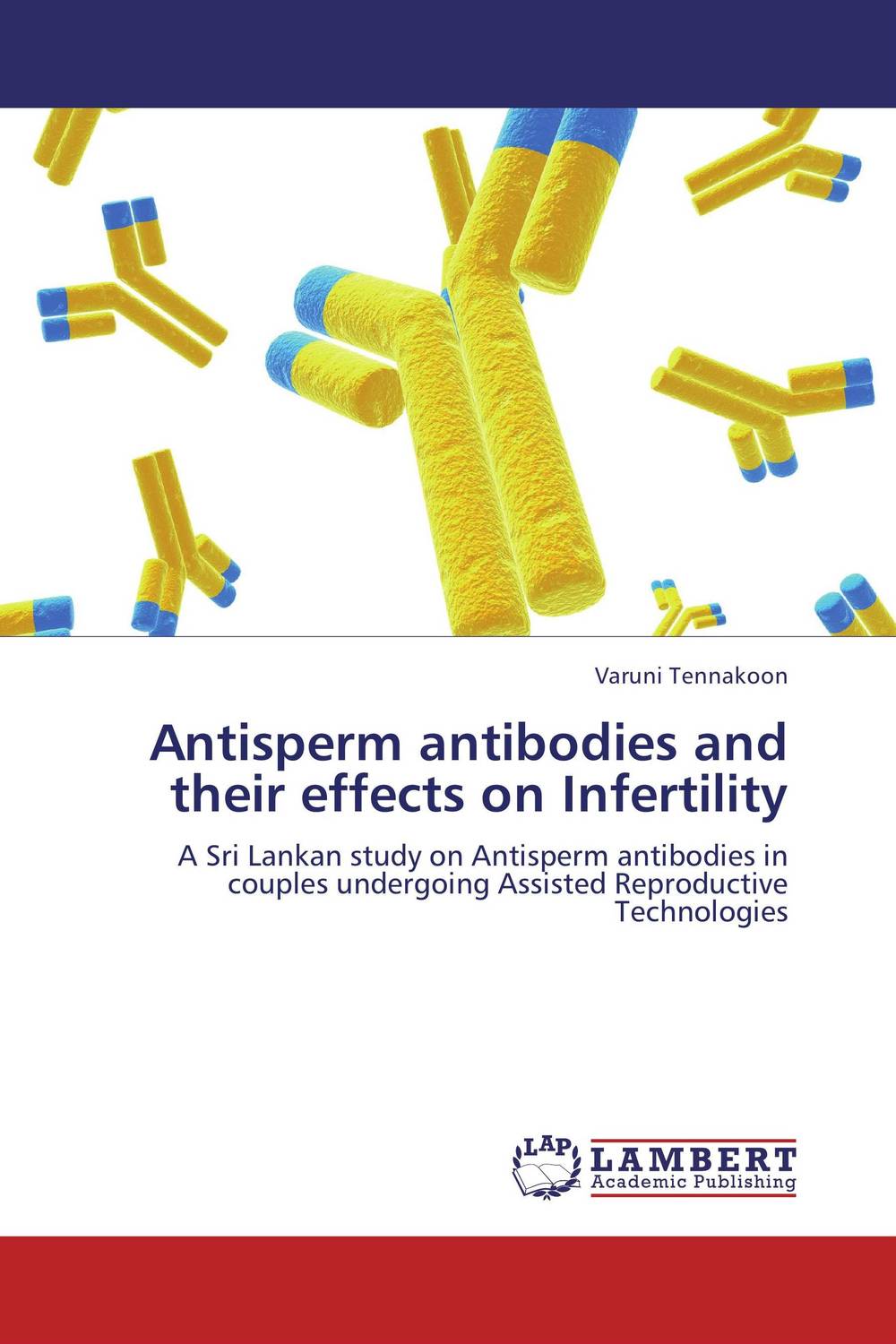Antisperm antibodies and their effects on Infertility patterns and causes of infertility