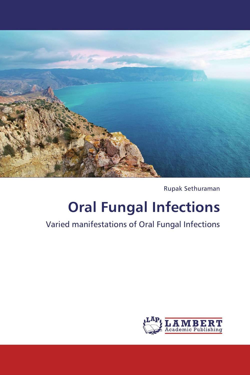 Oral Fungal Infections murine immune responses to strains of candida albicans
