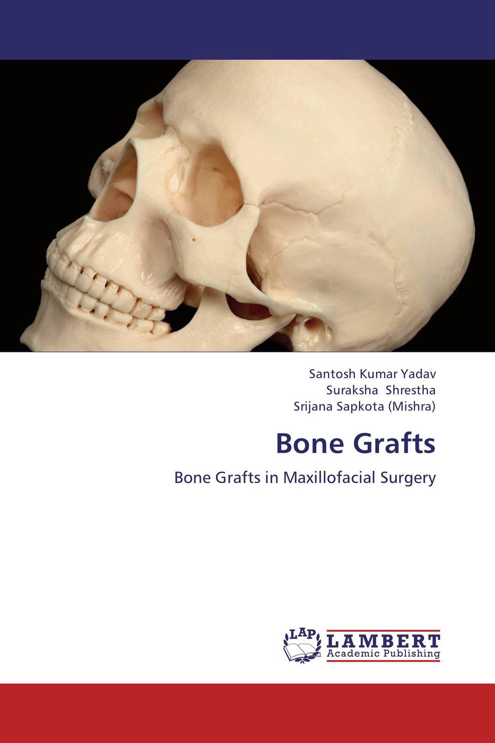 Bone Grafts art of bone