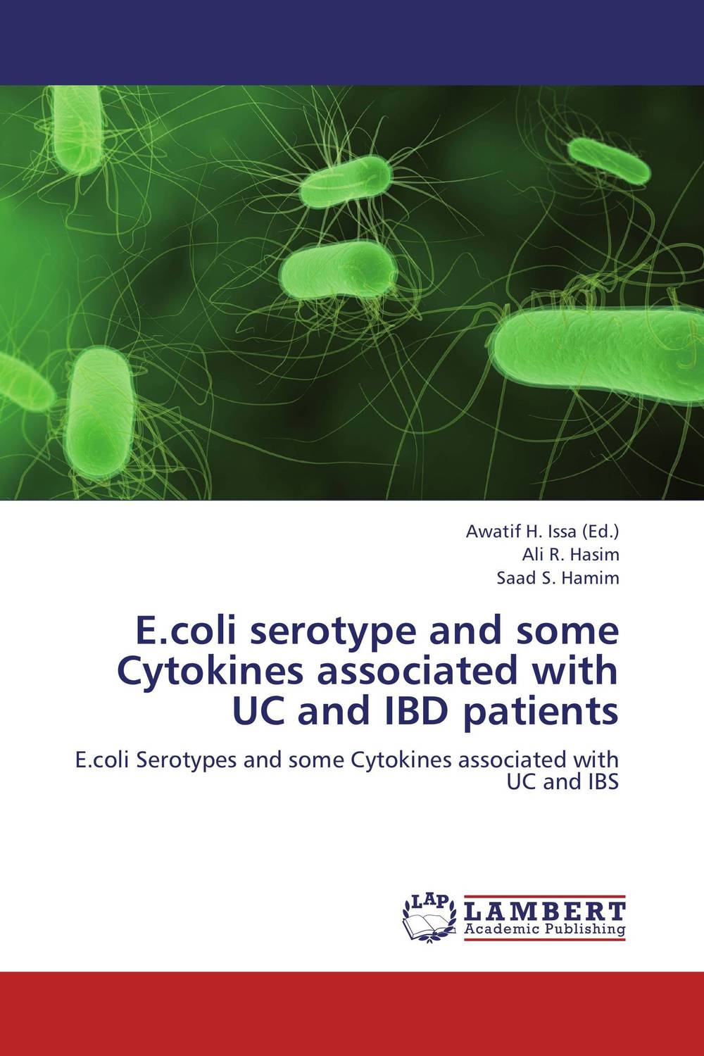 E.coli serotype and some Cytokines associated with UC and IBD patients mooren s ulcer and peripheral ulcerative keratitis