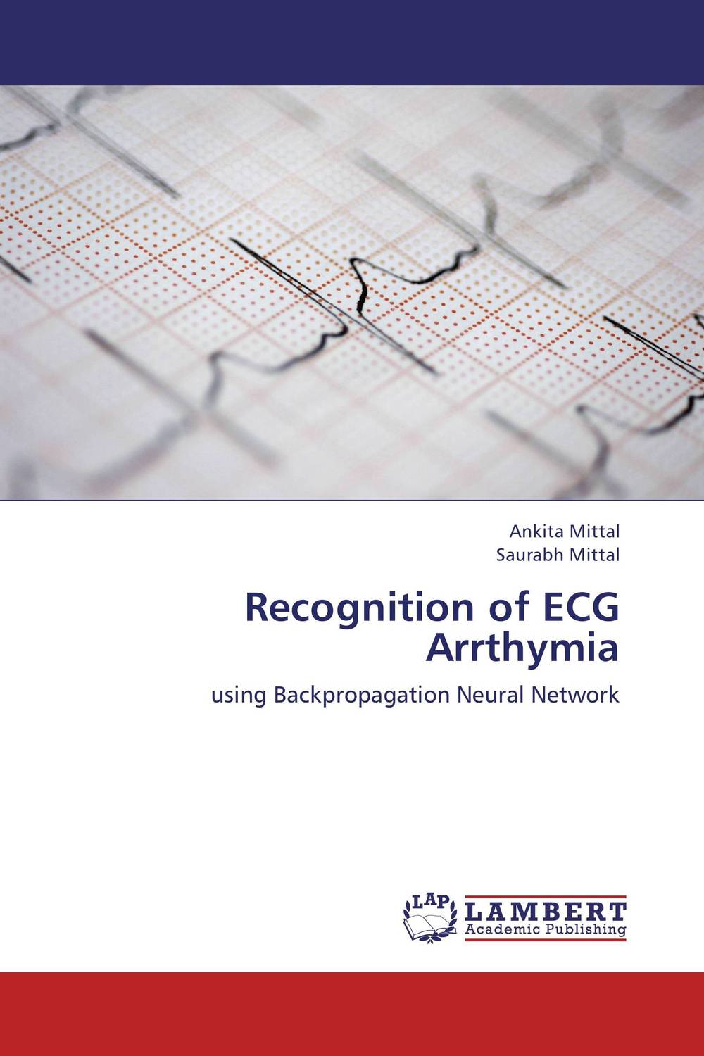 Recognition of ECG Arrthymia artificial neural network for studying human performance