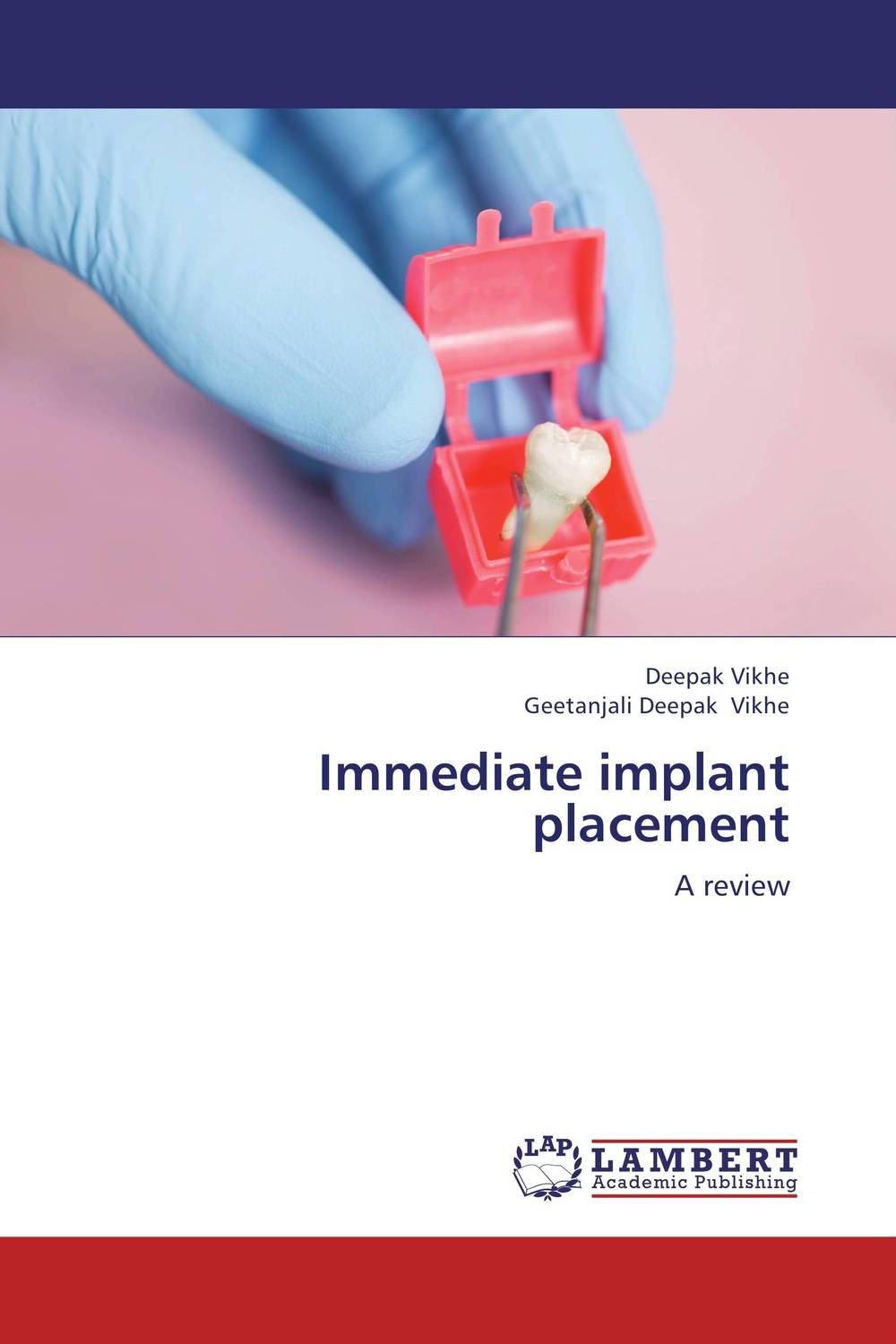 Immediate implant placement the effect of biological factors on bone healing in implant dentistry