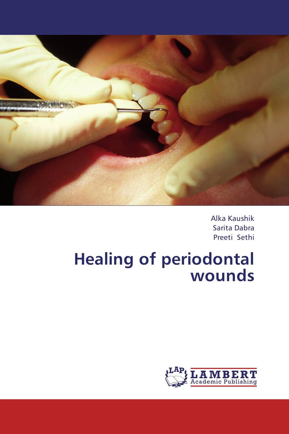 Healing of periodontal wounds tissue adhesive versus standard wound closure technique