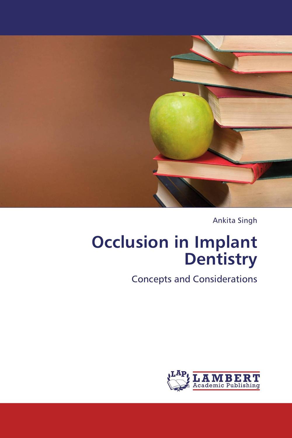 Occlusion in Implant Dentistry the effect of biological factors on bone healing in implant dentistry