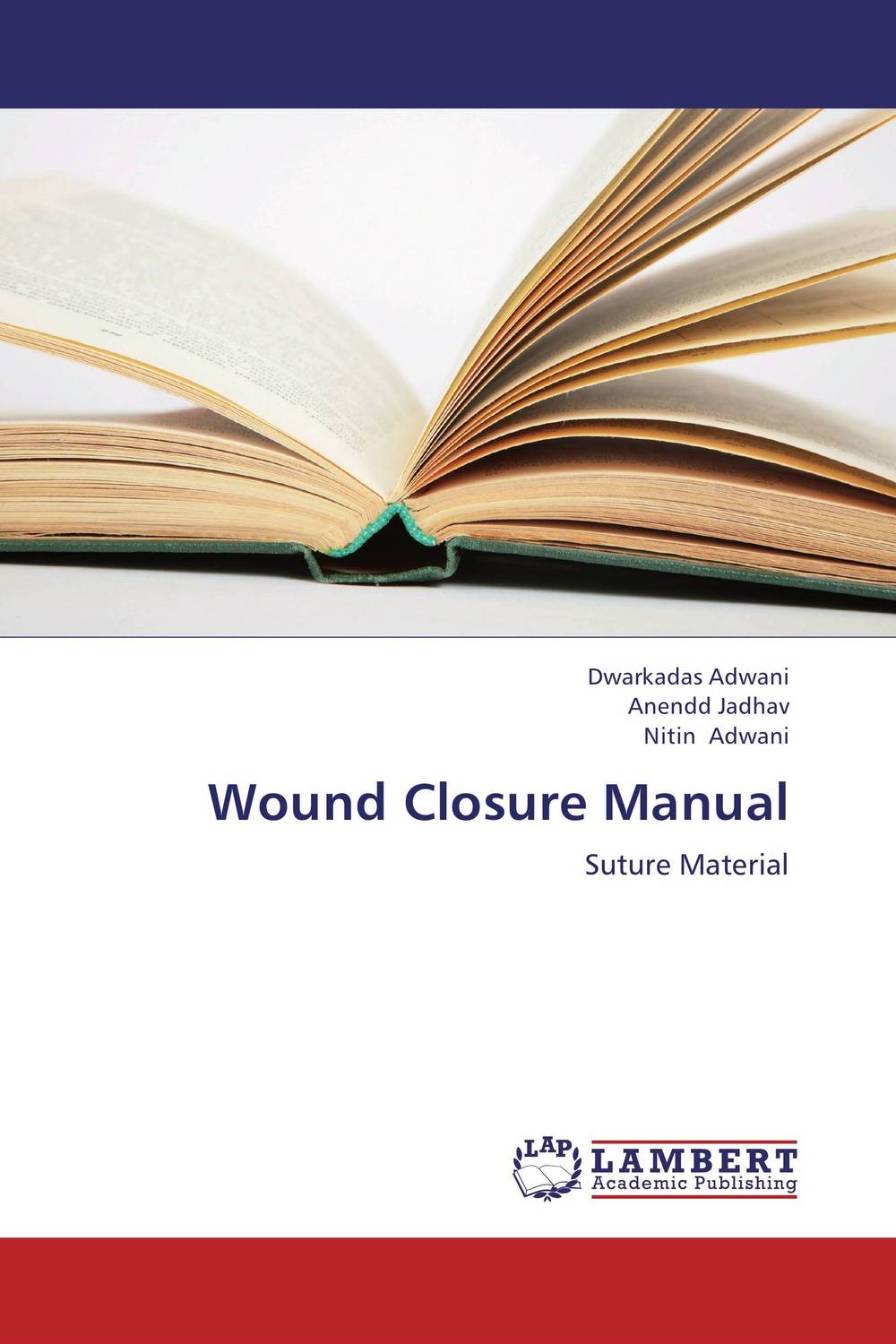 Wound Closure Manual tissue adhesive versus standard wound closure technique