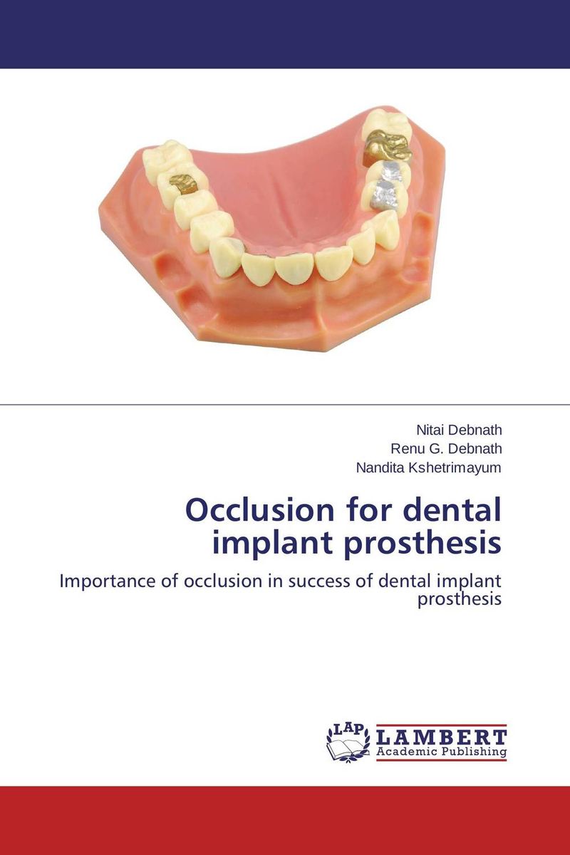 Occlusion for dental implant prosthesis the effect of biological factors on bone healing in implant dentistry