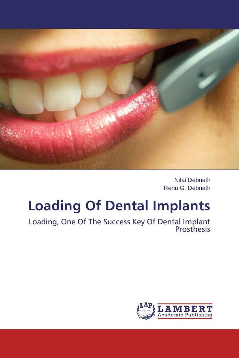 Loading Of Dental Implants the effect of biological factors on bone healing in implant dentistry