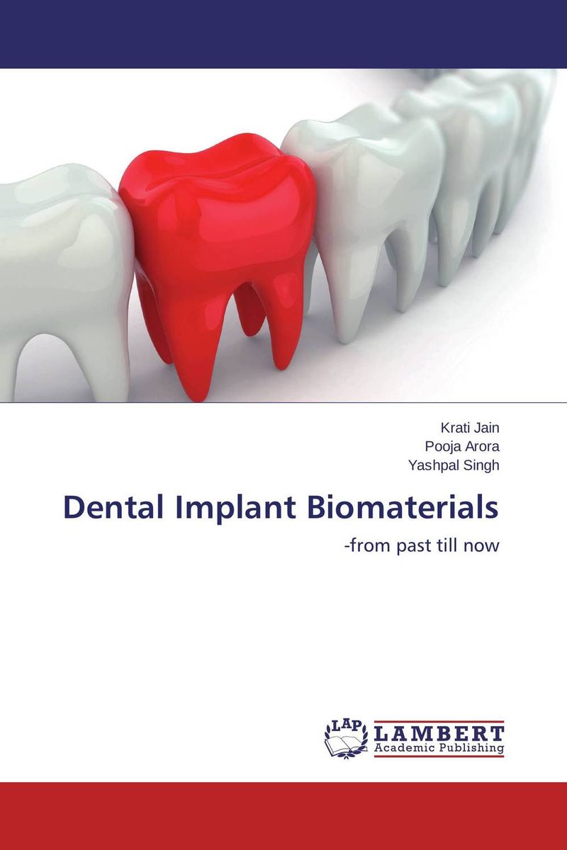 Dental Implant Biomaterials implants made easy