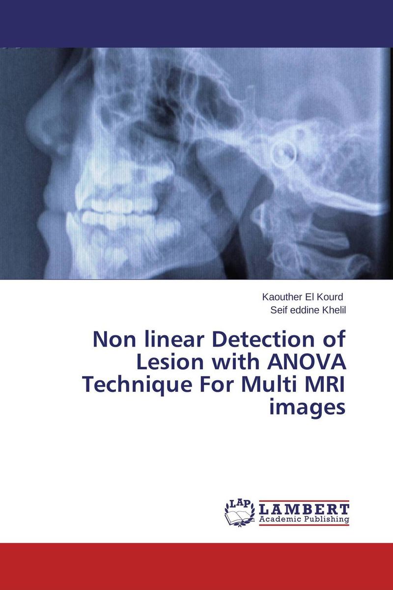 Non linear Detection of Lesion with ANOVA Technique For Multi MRI images white printed vest with keyhole design