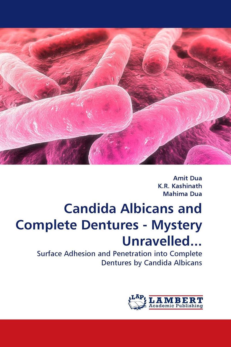Candida Albicans and Complete Dentures - Mystery Unravelled... murine immune responses to strains of candida albicans