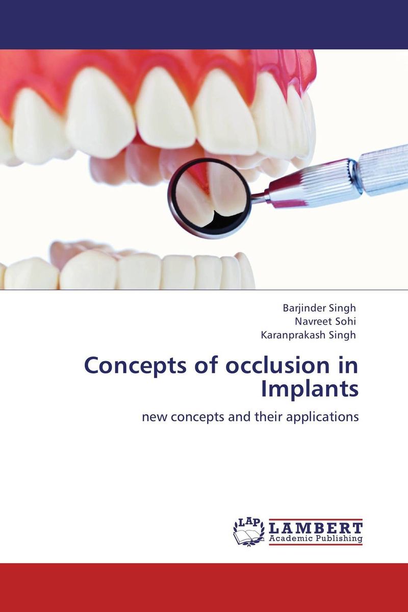 Concepts of occlusion in Implants the effect of biological factors on bone healing in implant dentistry