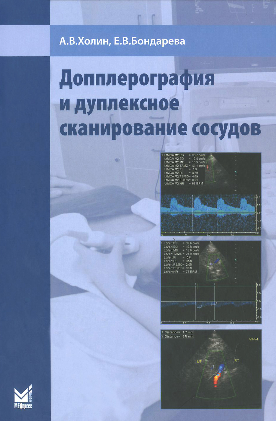 Допплерография и дуплексное сканирование сосудов. А. В. Холин, Е. В. Бондарева
