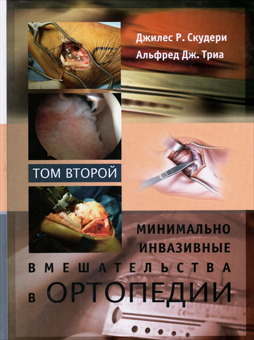 Минимально инвазивные вмешательства в ортопедии. В 2  томах. Том 2
