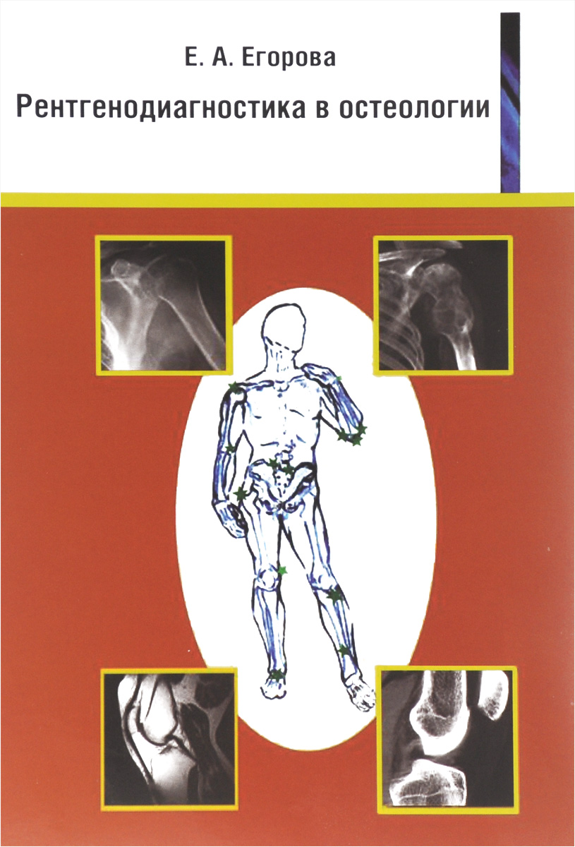 Рентгенодиагностика в остеологии. Учебное пособие. Е. А. Егорова