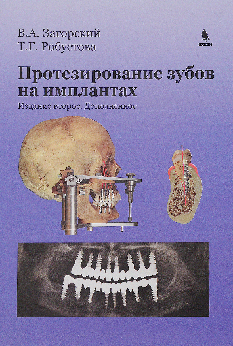 Протезирование зубов на имплантах. В. А. Загорский, Т. Г. Робустова