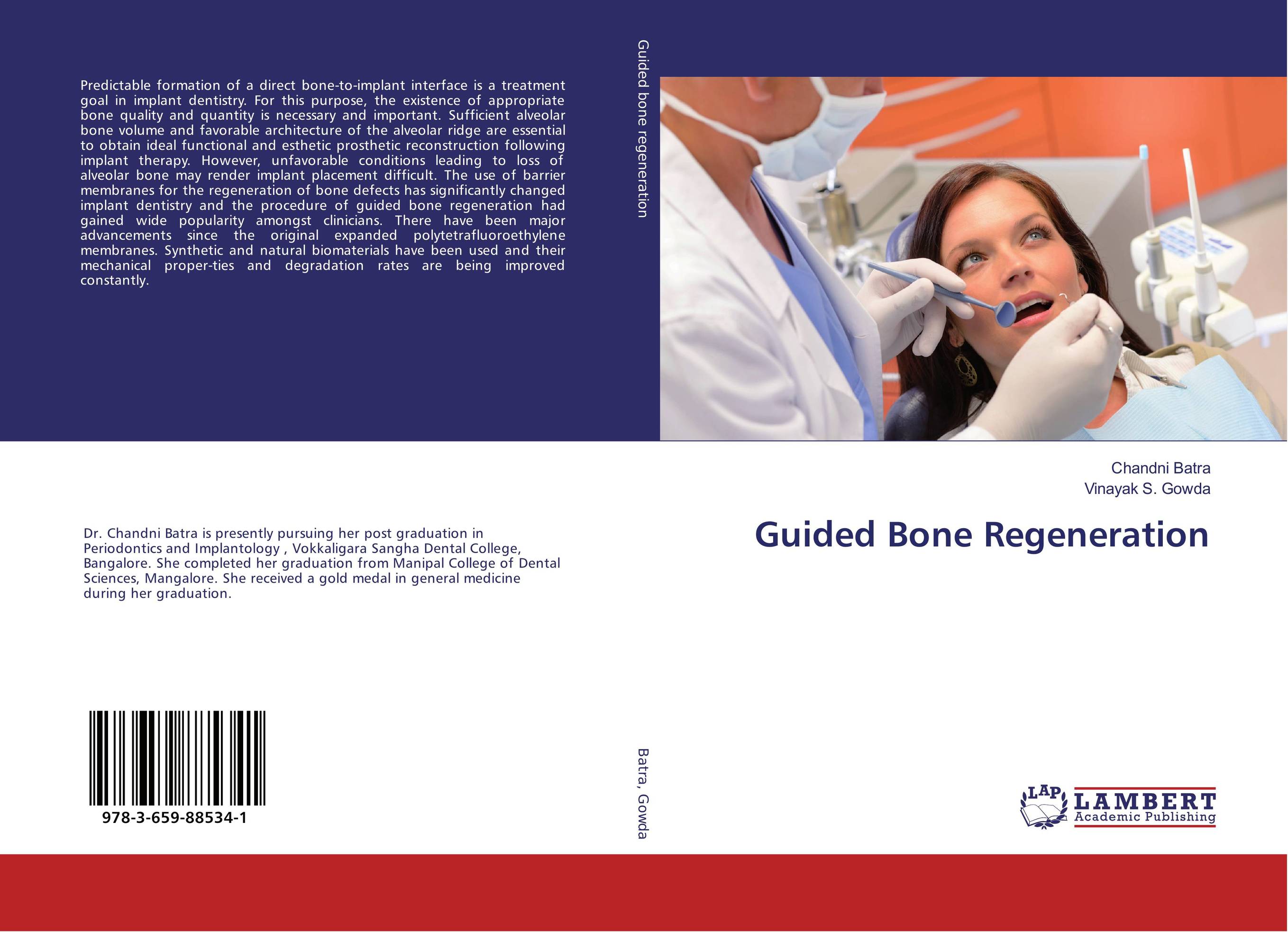 Guided Bone Regeneration art of bone