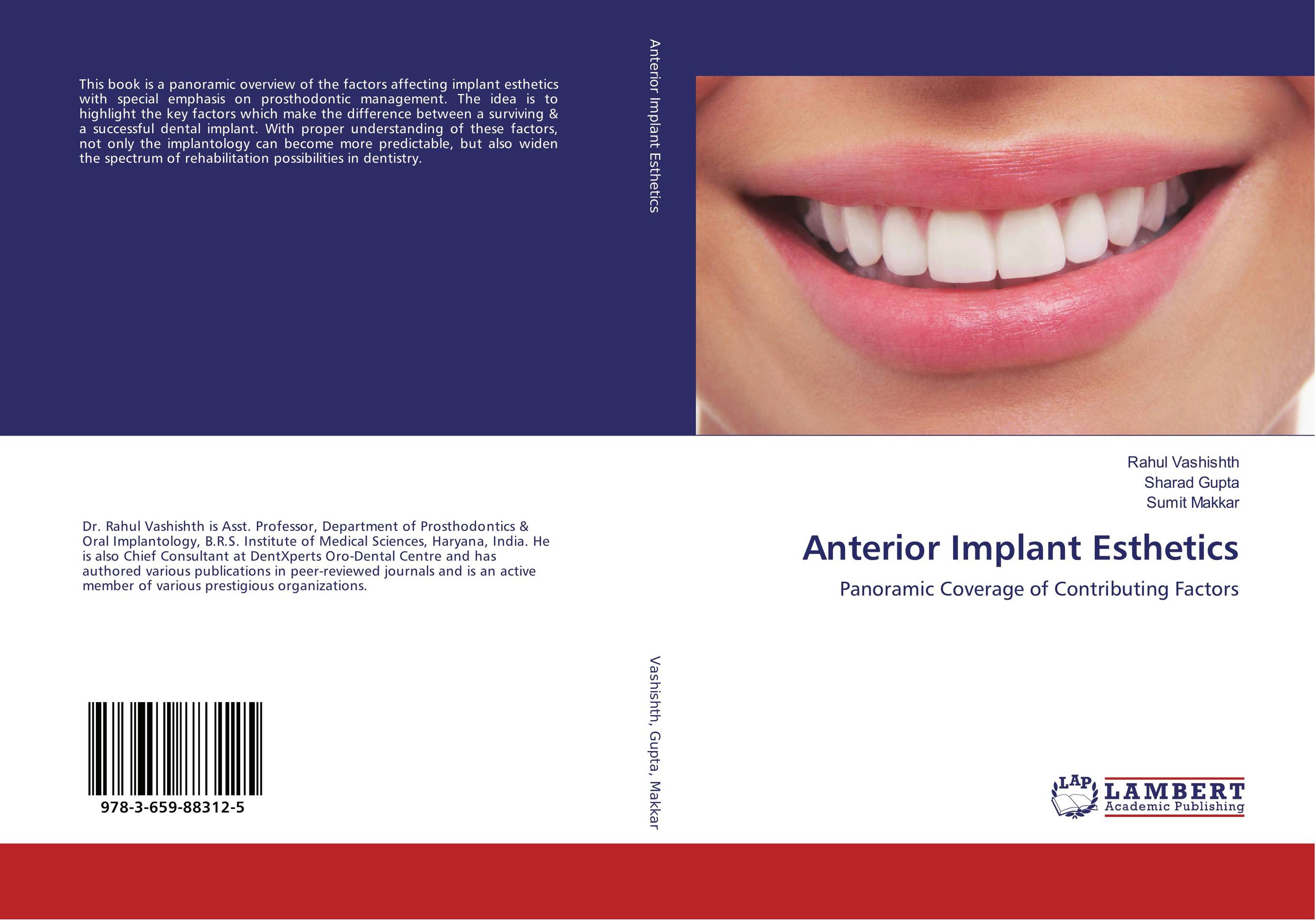 Anterior Implant Esthetics the effect of biological factors on bone healing in implant dentistry