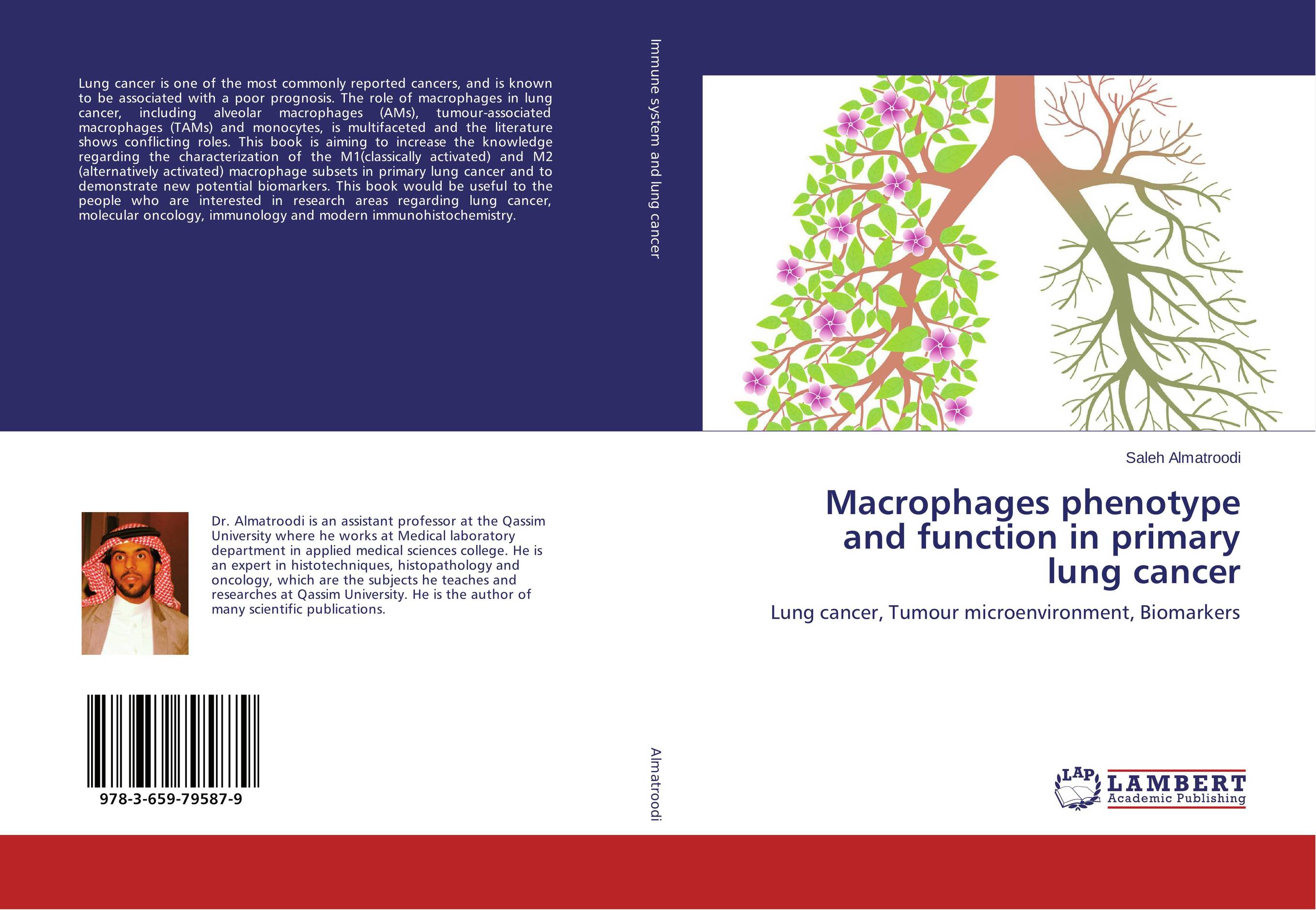 Macrophages phenotype and function in primary lung cancer enlarging human lung alveolar medical model bronchus anatomy teaching kit