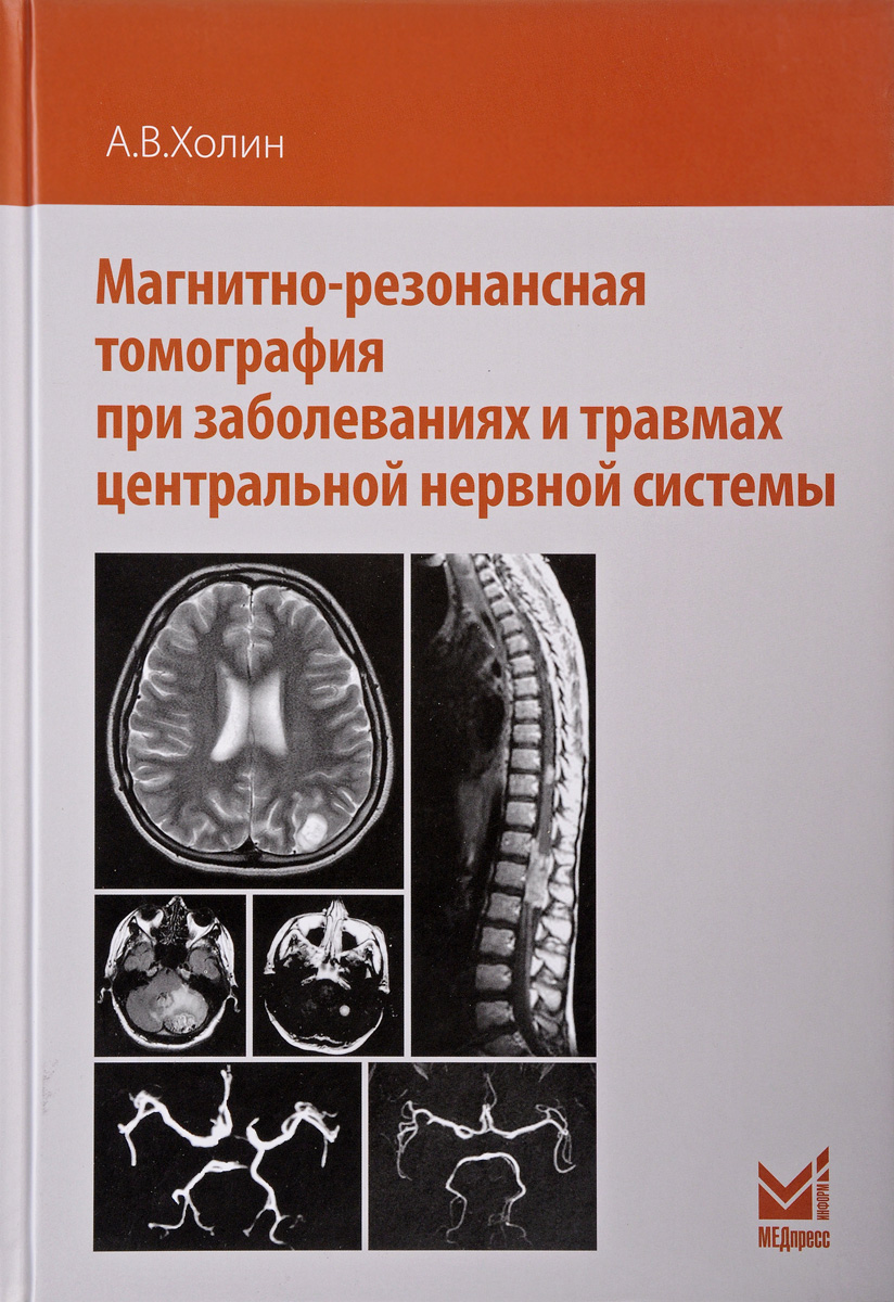 Магнитно-резонансная томография при заболеваниях и травмах центральной нервной системы. А. В. Холин