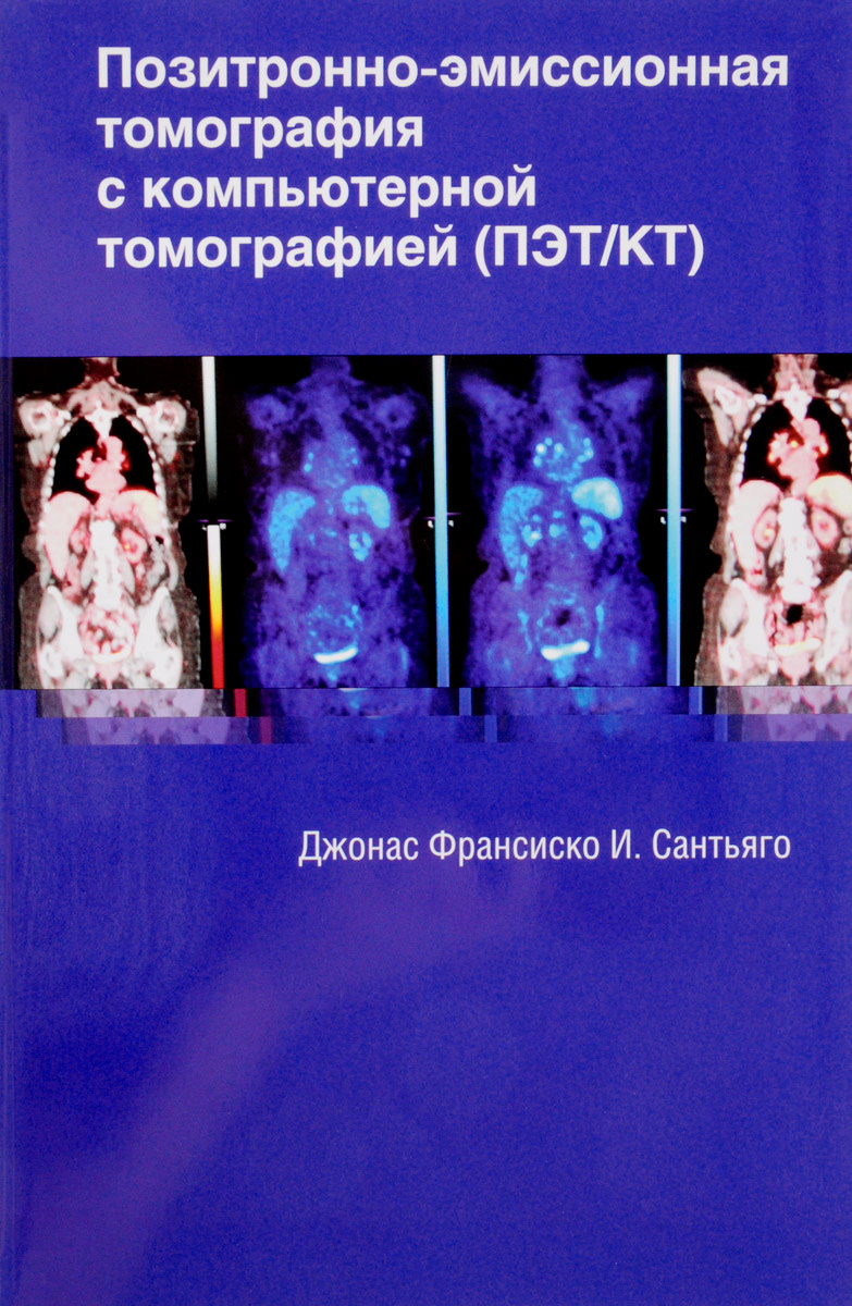 Позитронно-эмиссионная томография с компьютерной томографией. Джонас Франсиско И. Сантьяго