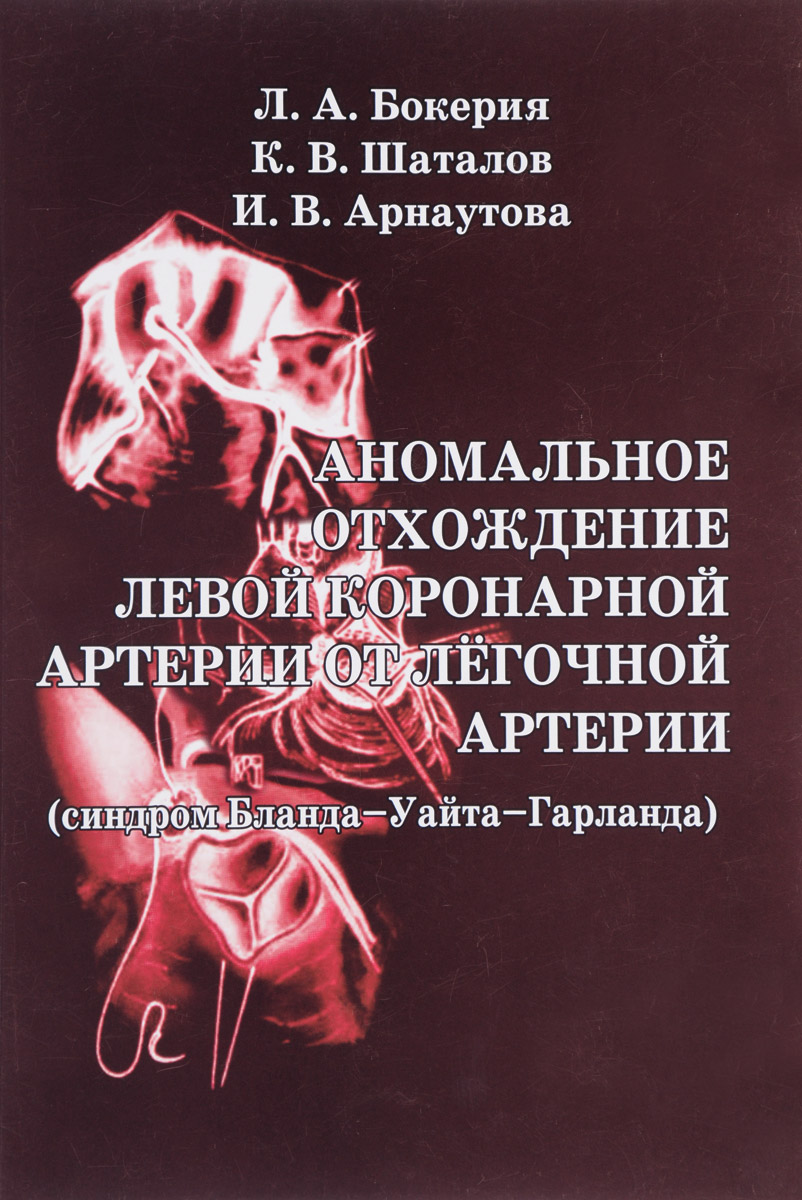 Аномальное отхождение левой коронарной артерии от легочной артерии (синдром Бланда-Уайта-Гарланда)
