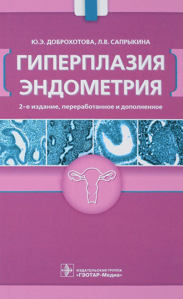 Гиперплазия эндометрия. Ю. Э. Доброхотова, Л. В. Сапрыкина