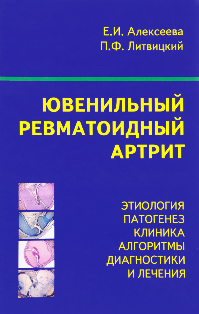 Ювенильный ревматоидный артрит. Учебное пособие