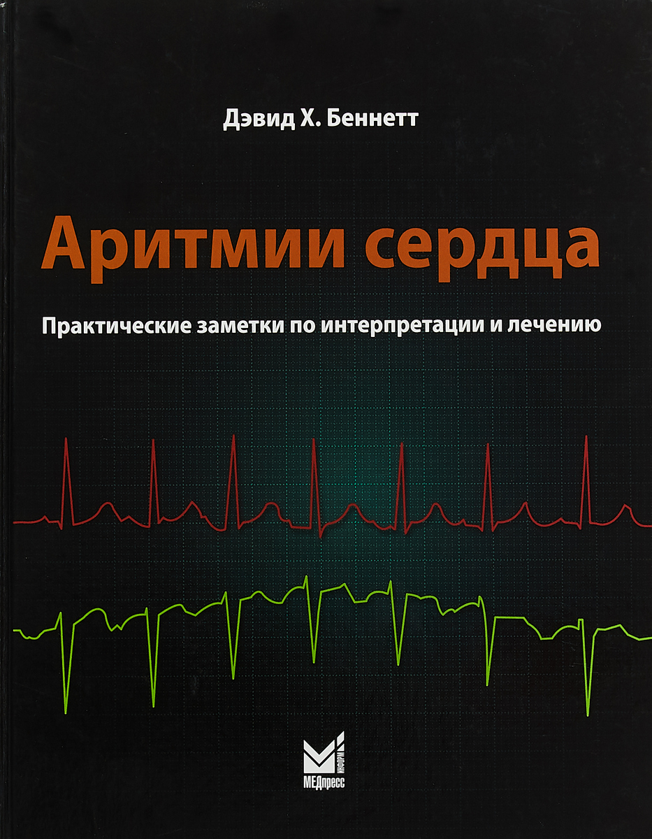 Аритмии сердца. Практические заметки по интерпретации и лечению. 2-е издание. Д. Беннетт, Д. Маскетти Аритмии сердца. Практические заметки по интерпретации и лечению. 2-е издание. Д. Беннетт, Д. Маскетти