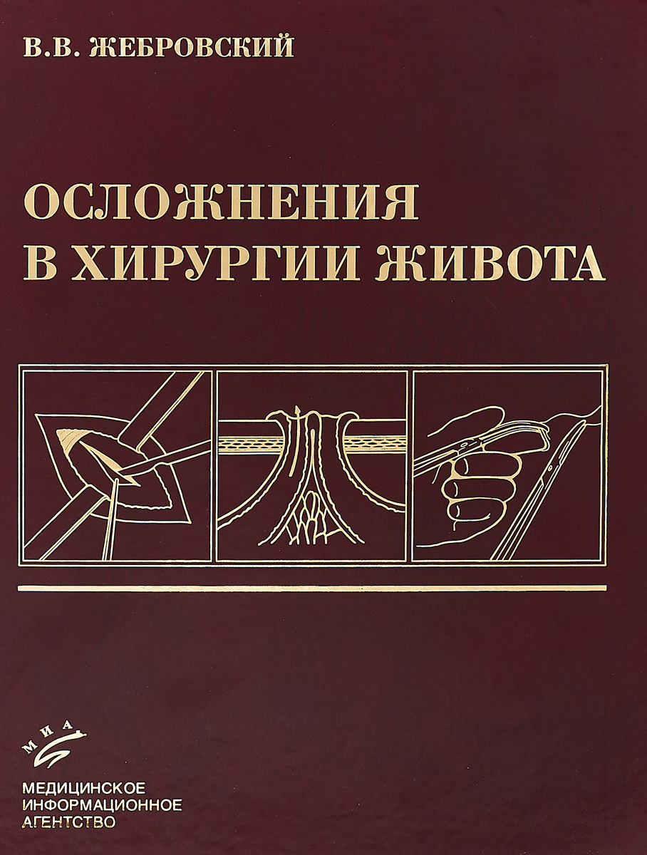 Осложнения в хирургии живота. Осложнения в хирургии живота.