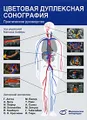 Цветовая дуплексная сонография